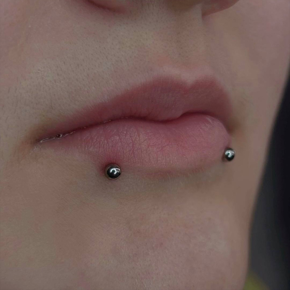 18